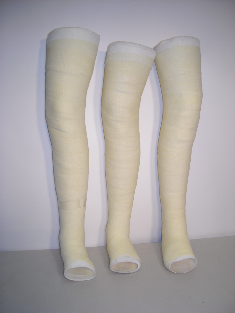 Plaster cast (leg)